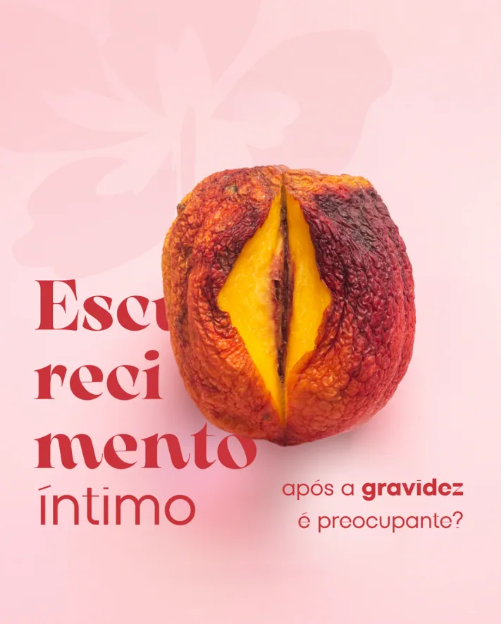 Capa de carrossel sobre escurecimento íntimo após a gravidez
